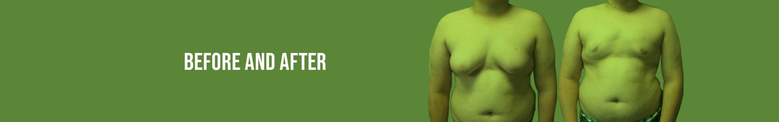 grade of gynecomastia surgery cost in india